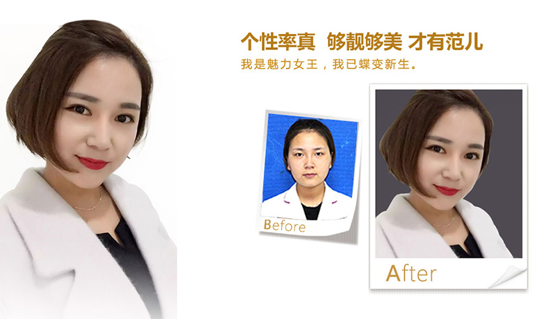 鄂州美鼻、V脸