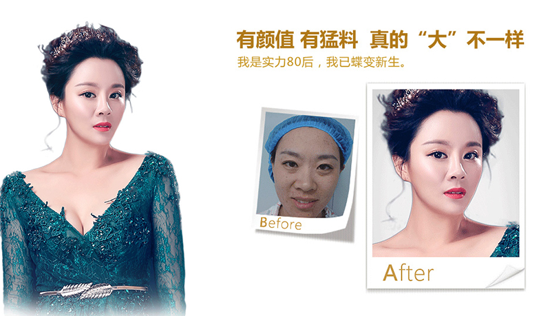 鄂州脂肪移植、隆鼻