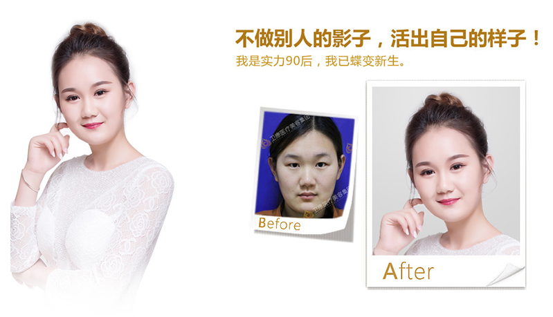 鄂州纳米脂肪移植