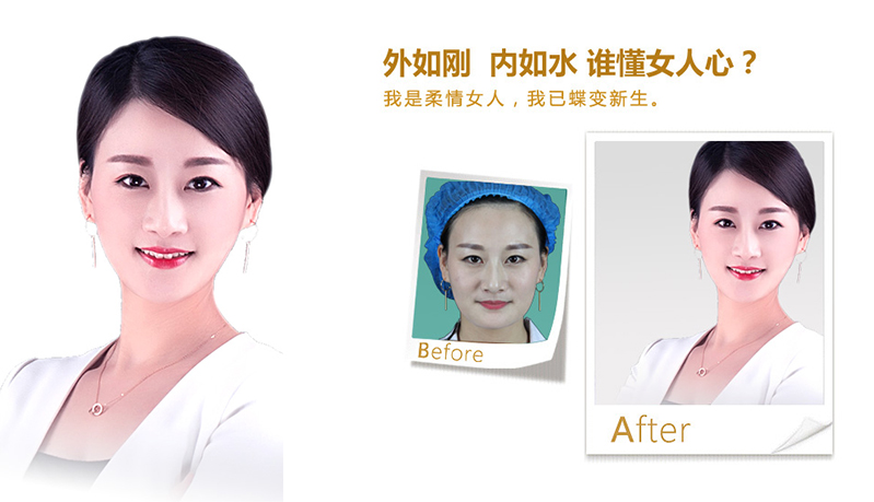 鄂州V脸、线雕隆鼻